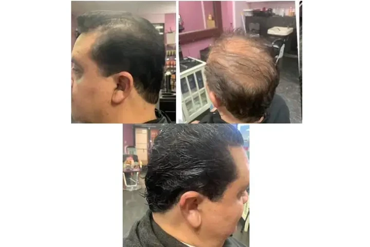 HAIR ARDO SHAMPOO image 1