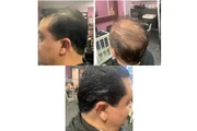 HAIR ARDO SHAMPOO en Los Angeles