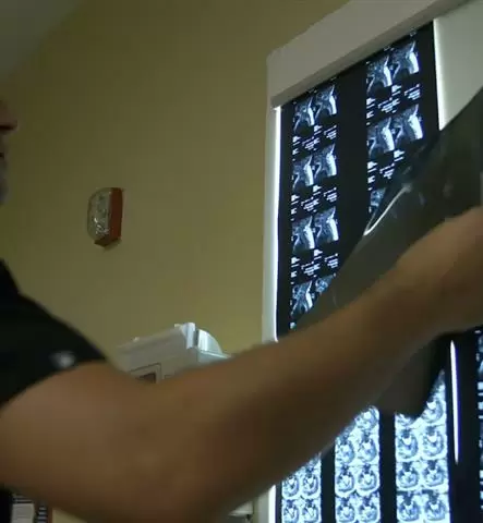 Advanced Spine Center in NJ image 3