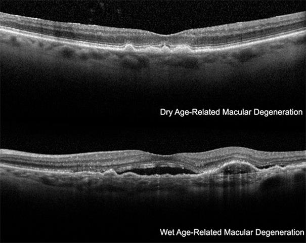 Macular degeneration doctors image 3