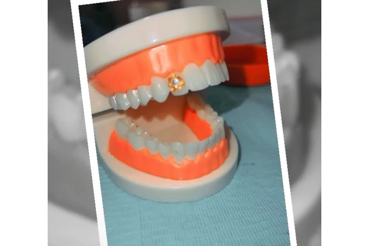 Blanqueamiento Dental $50 dls image 5