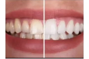 CLINICA DENTAL  KORSO en Caracas