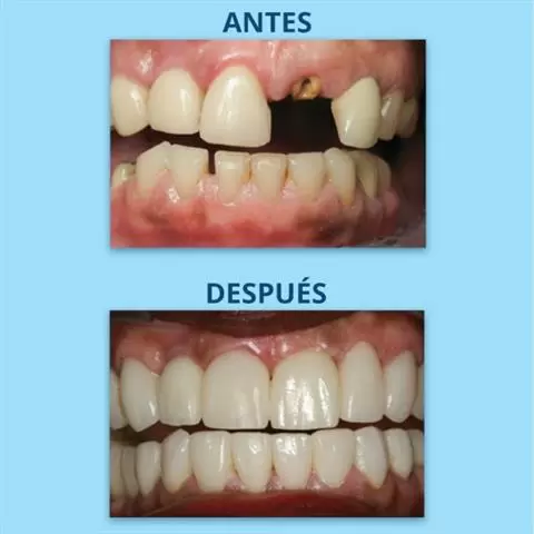 Dr. Soto The Downey Dentist image 10