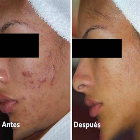 Upper Layers Skin Care image 3