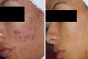Upper Layers Skin Care thumbnail 3