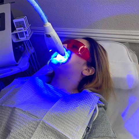Jeny Reyes Teeth Whitening image 4