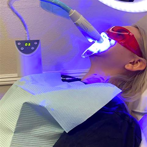 Jeny Reyes Teeth Whitening image 3