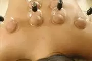 MASSAGE ANTI-ESTRESS CUPPING thumbnail