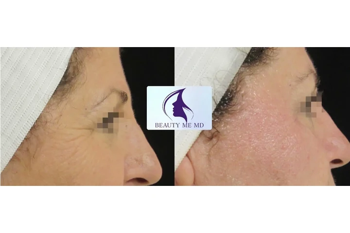Aesthetic Treatments image 5