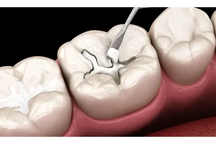 Clínica Dental Económica image 7