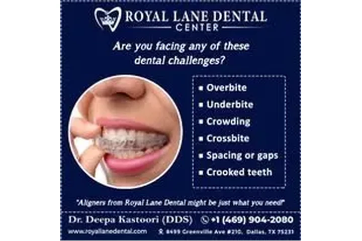 Clear Aligners in Dallas image 2