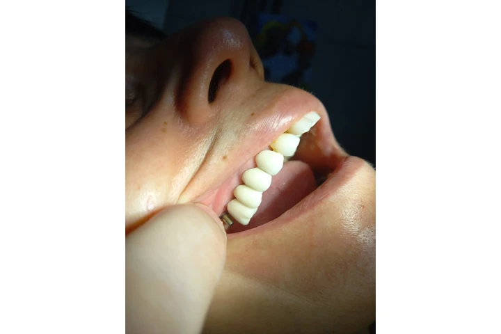 ODONTOLOGIA PRIVADA IMPLANTES image 1