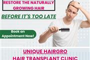 hair transplant cost en Imperial County