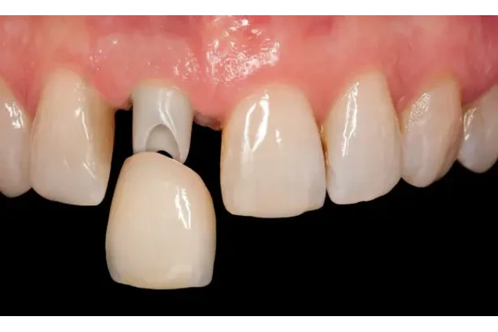 DENTISTA GENERAL FAMILIAR image 4