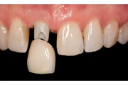 DENTISTA GENERAL FAMILIAR thumbnail