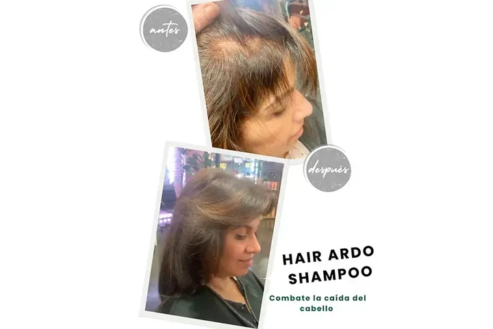 HAIR ARDO SHAMPOO image 2