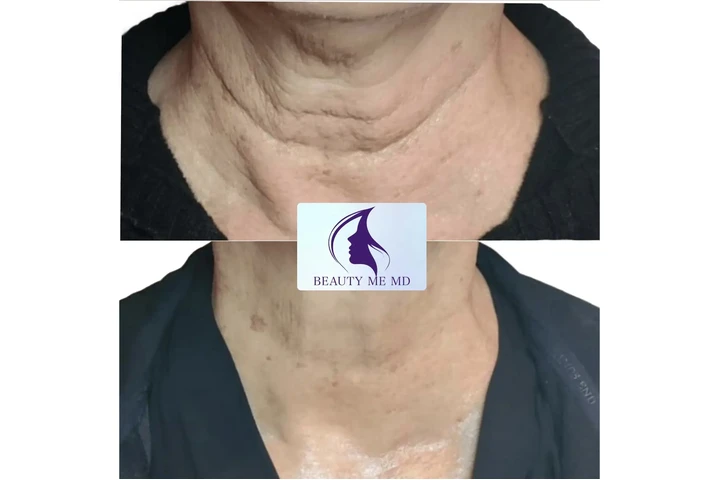 Aesthetic Treatments image 3