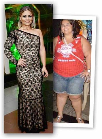 HydroLean XT Gold: Weightloss image 2