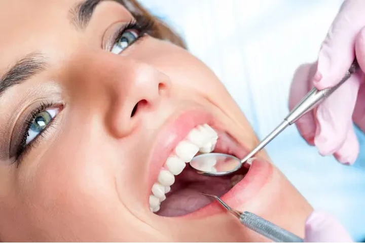 Top Teeth Whitening Treatment image 1