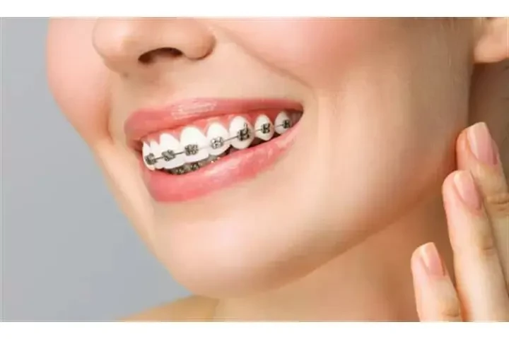 Dentista Cosmético image 2