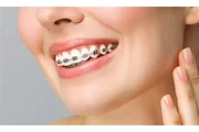 Dentista Cosmético thumbnail