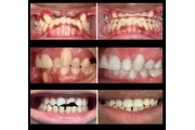 SONRISA PERFECTA EN VAN NUYS thumbnail