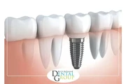 DENTISTA CERCA DE MÍ en Los Angeles