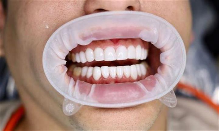 Bonita Smile Dental Center image 9