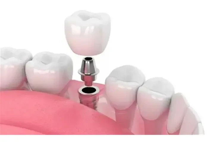 ¡YA NO VAYA MÁS A TIJUANA! image 1