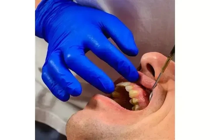 Implantes Dentales desde $799 image 6