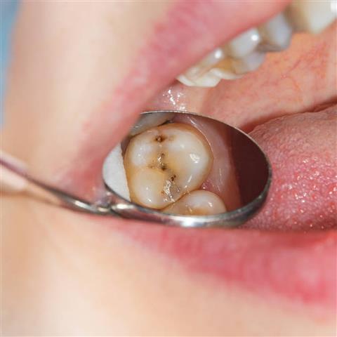 Affordable Dentist image 4