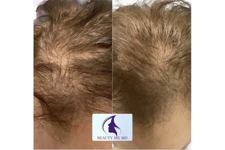 Aesthetic Treatments image 4