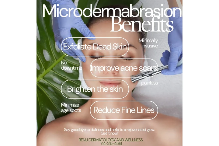 MICRODERMABRASION image 2
