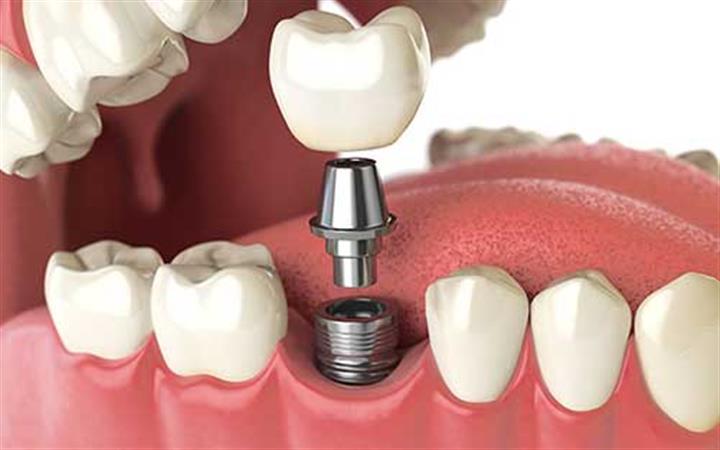 Ace Dental Group image 4