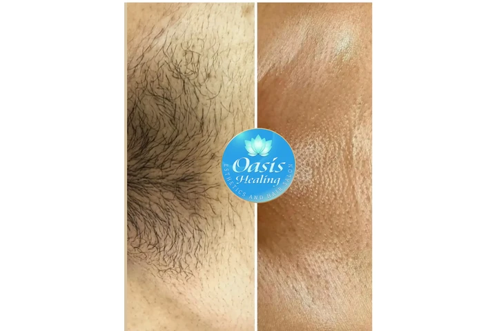 CURSO WAX DEPILACION CERA image 3