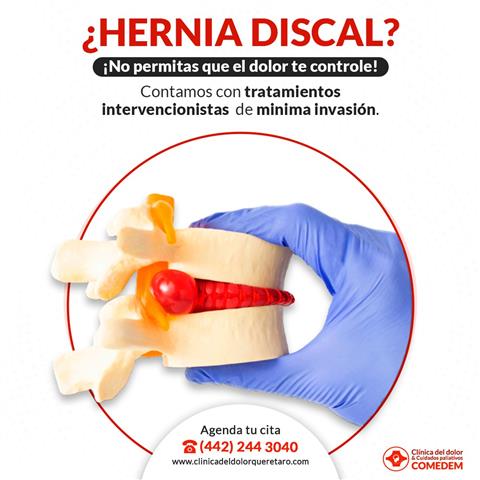 ¿HERNIA DISCJAL? image 1