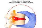 ¿HERNIA DISCJAL? en Queretaro