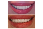 Rialto Dental Implant Studio thumbnail 3
