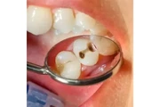 DENTISTA EN VAN NUYS en Los Angeles