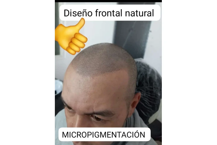 Micropigmentacion capilar bogo image 1