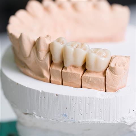 Implantes Dentales en Rialto image 2