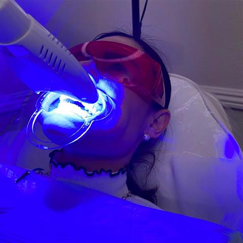 Jeny Reyes Teeth Whitening image 2