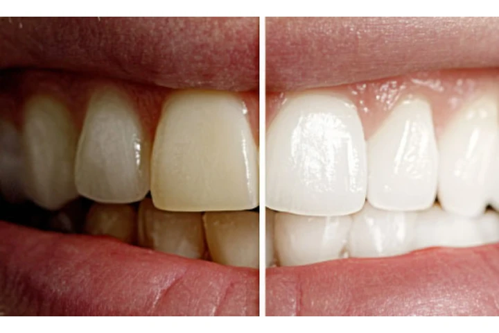 Pico Rivera Family Dentistry image 4