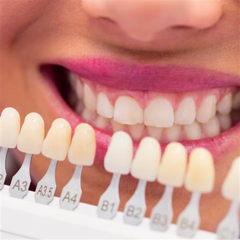 Implantes Dentales en Rialto image 4