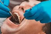 Affordable Dentist en Orange County