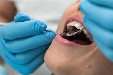 DENTISTA EN VAN NUYS en Los Angeles