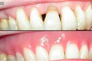 Smile Bright with top Dentist thumbnail