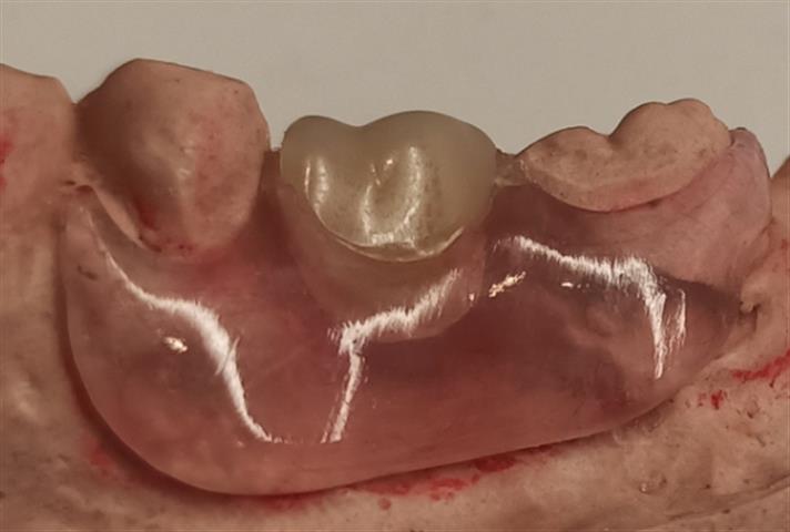 Odontologia y Laboratorio Dent image 2