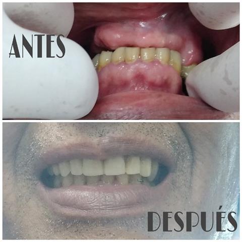 Odontologia y Laboratorio Dent image 5