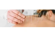 Acupuncture Toronto en Toronto